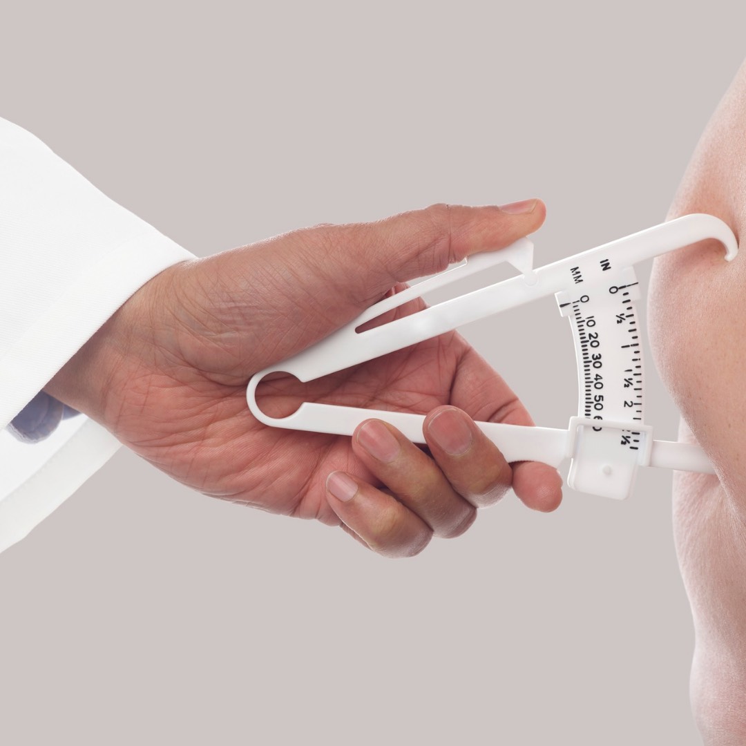 ¿La cirugía bariátrica es para mí?