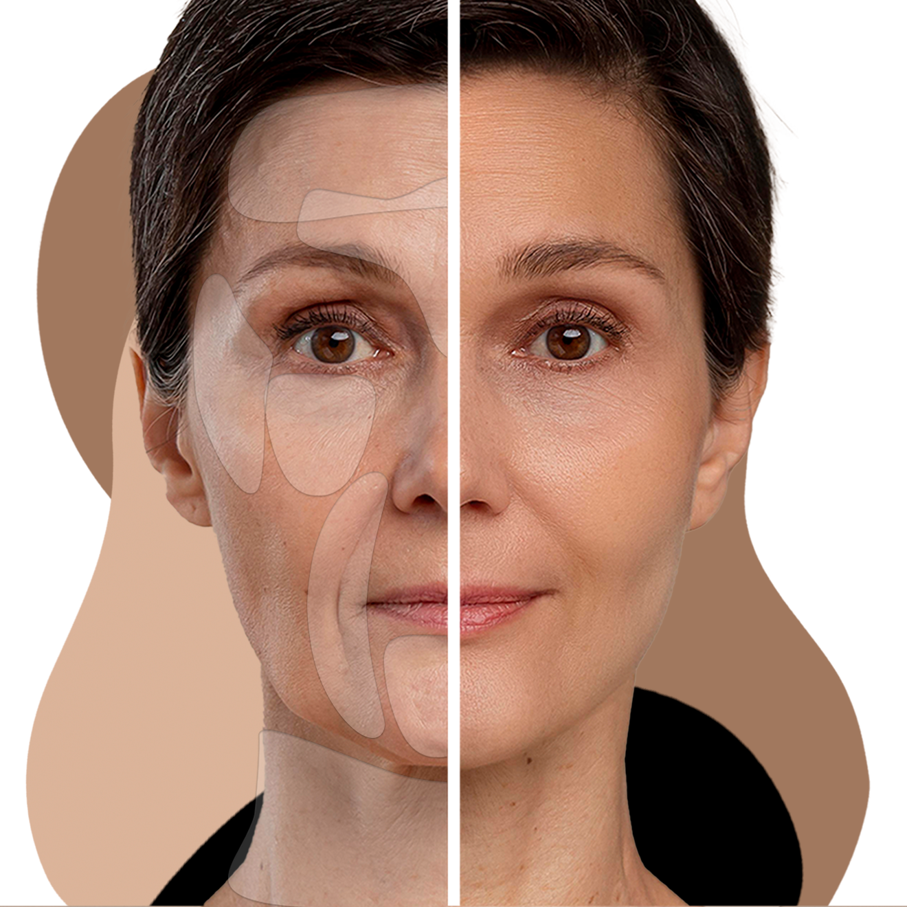 CARA. YOUR BEST SELF” LOS PARCHES DE SILICONA QUE  REVITALIZAN Y REGENERAN LA PIEL