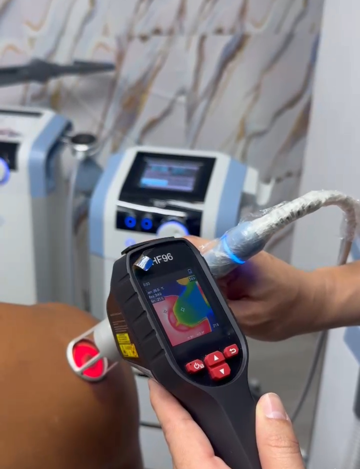 Tecnología regenerativa para el tratamiento de lesiones