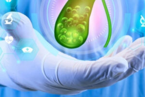 Atender a tiempo la litiasis vesicular evita complicaciones graves