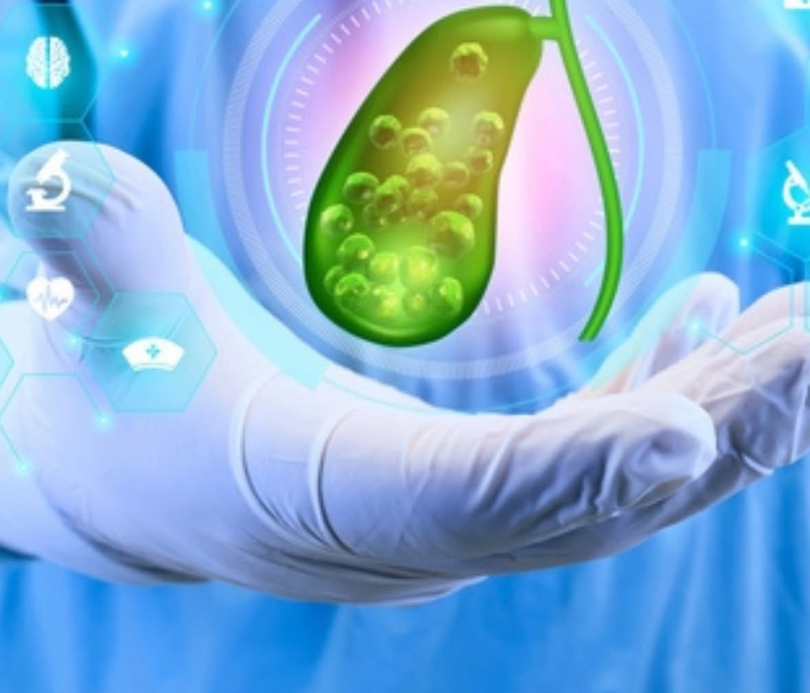 Atender a tiempo la litiasis vesicular evita complicaciones graves